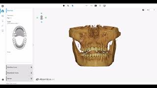 🔍 Unlock the true potential of implant planning with Atomica AI's Curve Generation feature! 🚀