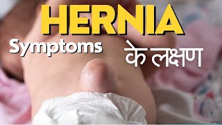 Symptoms of hernia | Hernia ke lakshan | हर्निया के लक्षण | Hernia symptoms in Hindi