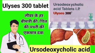 Ulyses 300 tablet uses in hindi/Ursodeoxycholic acid tablets ip 300 mg/HealthtipswithKhan.Ulyses 300