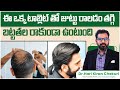 Finasteride Benefits for Hair Growth || Best Hair Growth Tips in Telugu || ReDefine Channel