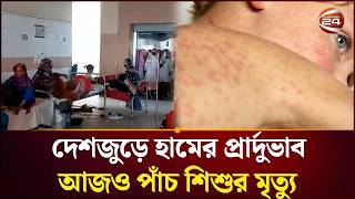 হাসপাতালে রোগীর চাপ; বাড়ছে আতঙ্ক | Measles Outbreak | Bangladesh Health | Child Health | Channel24