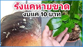 รังแคหายขาด ‼ สุดยอดสมุนไพรไทย แก้คัน หนังหัวมันเยิ้ม ด้วยงบแค่ 10 บาท l สรรหามาาทำ