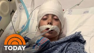 In Twist Of Fate, Motocross Accident Saves 9-Year-Old’s Life | TODAY