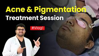 Best Treatment for Acne \u0026 Pigmentation: Peels + Pico Laser! | 1st Session Vlog | Clear Skin, Pune