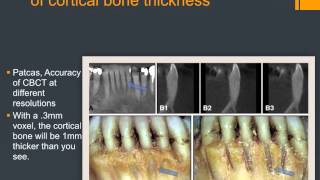 CBCT in Orthodontics - Part 1