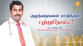 குழந்தைகளை பாதிக்கும் புற்றுநோய்..! - டாக்டர் . ருமேஷ் சந்தர், பி.எஸ்.ஜி மருத்துவமனை