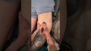 Shockwave Therapy BREAKS Sciatic Nerve Adhesion! | Real Pain Relief