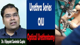 Urethral Stricture Surgery Video 4 - OIU (Optical Urethrotomy)