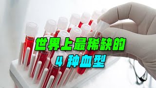 全球僅此一例的血型，比熊貓血珍貴3000倍，竟然被中國發現！