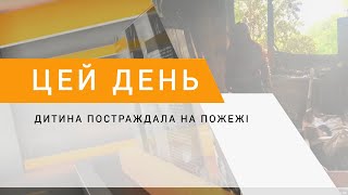 Дитина постраждала на пожежі