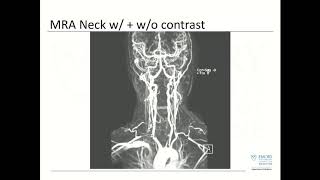 Emory Cardiology Grand Rounds 3-26-2018