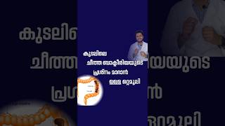 കുടലിലെ ചീത്ത ബാക്ടീരിയയുടെ പ്രശ്നം മാറാൻ ഉള്ള ഒറ്റമൂലി #shortsfeed #shorts