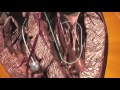 corevalve animation full procedure