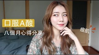 口服A酸對抗痘痘後續更新！八個月心得 ｜Leda zeng