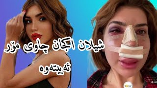 شیلان اکجان ڕوونکردنەوە کرد بۆ چاوی مۆر بۆتەوە shilan akcan