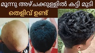 3 week Hair growth challenge in Malayalam|| വളരില്ല എന്ന് പറഞ്ഞവർക്കുള്ള മറുപടി 🔥