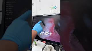 Equine Endoscopy | Identifying Gastric Ulcers in Horses