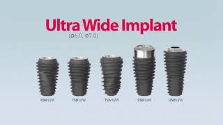 Ultra wide Implant ฝังรากเทียมทันทีหลังถอนฟันกราม หรือหลังถอนรากฟันเทียมล้มเหลว