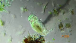 4K Microscopic Monogononta Rotifer Feeding