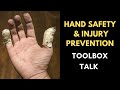 Hand Safety And Injury Prevention Toolbox Talk