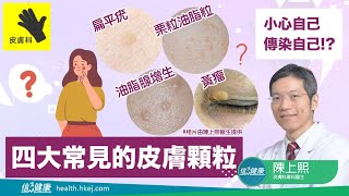 【皮膚百科】四大常見的皮膚顆粒