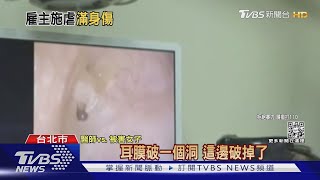 滿身傷! 控遭雇主施暴14個月 女移工提告｜TVBS新聞