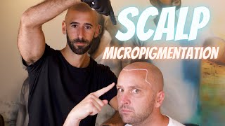 Scalp Micropigmentation in New York w/ Matt Iulo