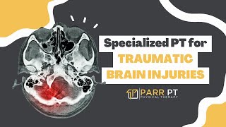 Specialized Physical Therapy for Traumatic Brain Injuries | Brain Injury Specialist