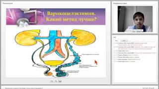 Варикоцеле и мужское бесплодие. Когда нужно оперировать?