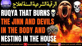 Ultimate Ruqya Sharia Dua That Burns The Jinn And Devils In The Body And Nesting In The House.