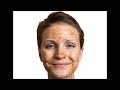 remove sun tan and pigmentation naturally video specially for delhi girls