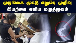 முழங்கை மூட்டு எலும்பு முறிவை சரி செய்யும் மருத்துவம் | Putturkattu Treatment | Dr.R.S.Velumani