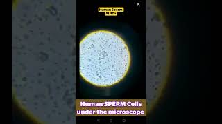 Focusing Human Sperm Cells under microscope at 40× #hematology #laboratory