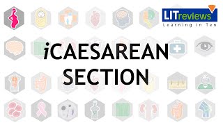 iCaesarean Section