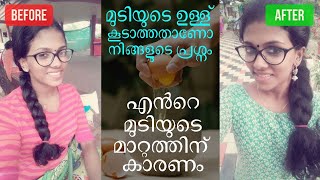 എന്റെ മുടിയുടെ മാറ്റത്തിന് ഉണ്ടായ കാരണം | മുടി ഉള്ള് കൂടാൻ #Alovera egg#hairpack