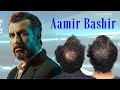 Actor Aamir Bashir Hair Transplantation at Eugenix | Hair Restoration