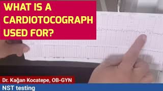 NST (non-stress) testing at 31st week because of contractions. What do probes on your belly detect?