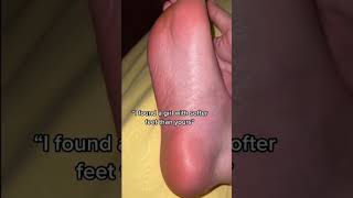 Baby Soft Feet | Smooth Feet Care for everyone | Foot Peel Mask | Best Foot Care | Treatment for dry