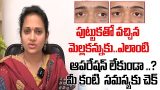 Squint Eye Treatment మెల్లకన్ను ట్రీట్మెంట్ Mella Kannu Treatment Sanjeevan Netralaya @ourdoctortv