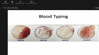 Immunology Fall 2021: Lecture 8 Techniques Using Antibodies