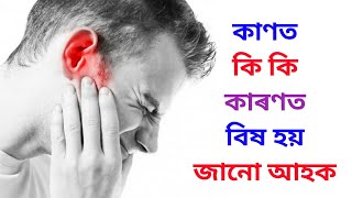 কাণত কি কি কাৰণত বিষ হয় জানো আহক