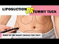 Difference Between Tummy Tuck and Liposuction| Handa Aesthetics & Plastics