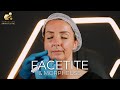 Facetite & Morpheus8 - Jenny - Yorkshire Skin Centre - Dr Raj Thethi