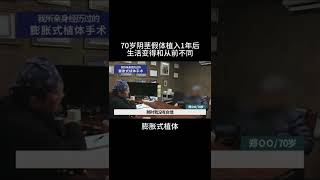 70歲老大爺，假陰莖植入體內一年後，接受採訪。#shorts