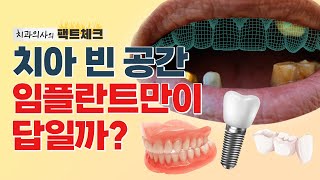 임플란트vs브릿지vs틀니 어떤 경우에 할까❓ | 차이점 전격비교!!