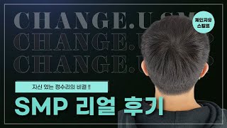 허전한 정수리 더이상 숨기지 마세요! SMP로 감쪽같이 해결 가능합니다 !!| 체인지유스칼프 공식채널