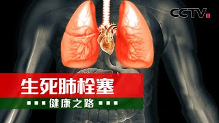 远离威胁生命的肺栓塞 这些人群需格外警惕！20230214 |《健康之路》CCTV科教