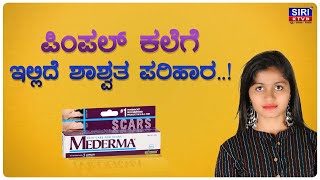 ಸುಟ್ಟ ಗಾಯದ ಕಲೆಗೆ ಇಲ್ಲಿದೆ ಮದ್ದು | Mederma Cream | Remove Pimple Marks And Acne Scars | Siri Tv