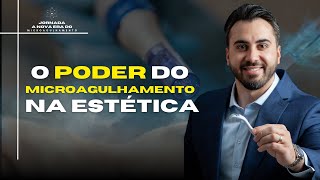 O poder do Microagulhamento na estética | Aula 1