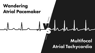 Wandering Atrial Pacemaker vs Multifocal Atrial Tachycardia - ECG (EKG) Interpretation - MEDZCOOL